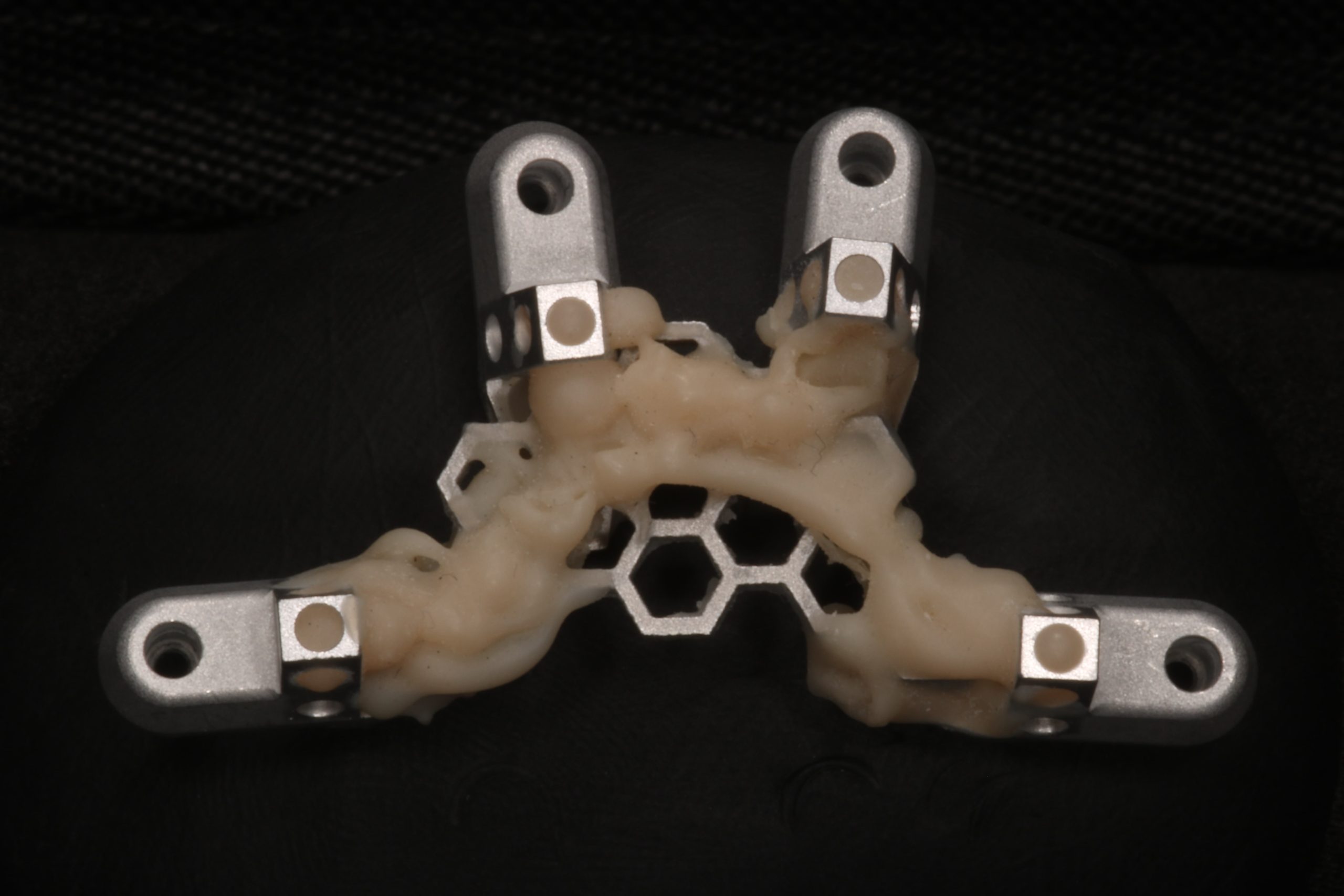 OPTISPLINT 4-Body Scan Kit