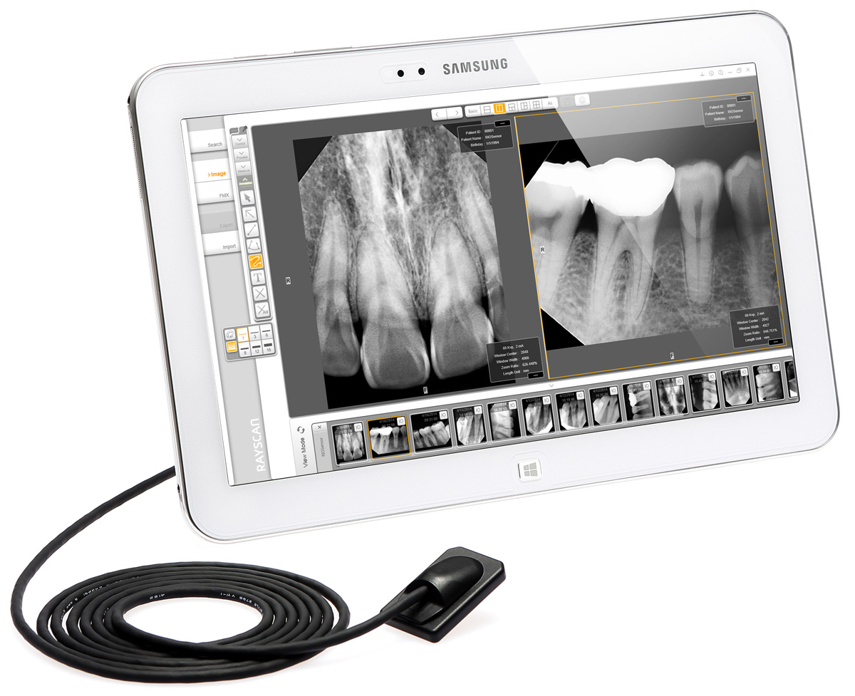 RIOSensor Intraoral Imaging Sensor