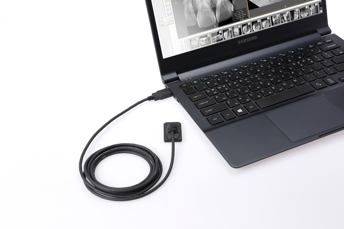 RIOSensor Intraoral Imaging Sensor