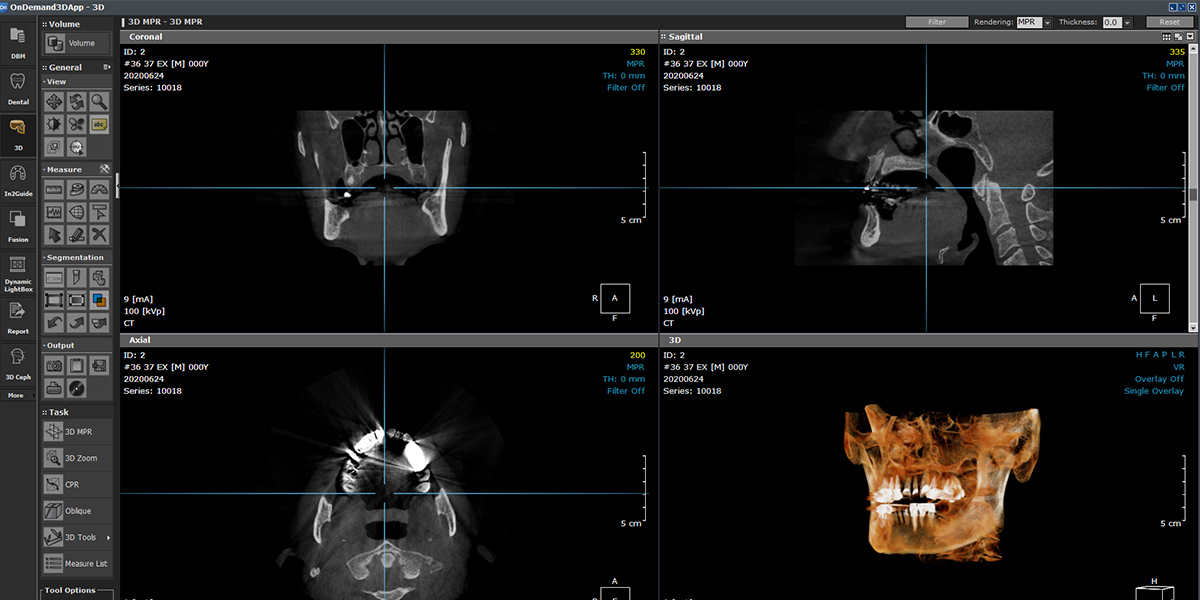 Software OnDemand3D interpretare CBCT