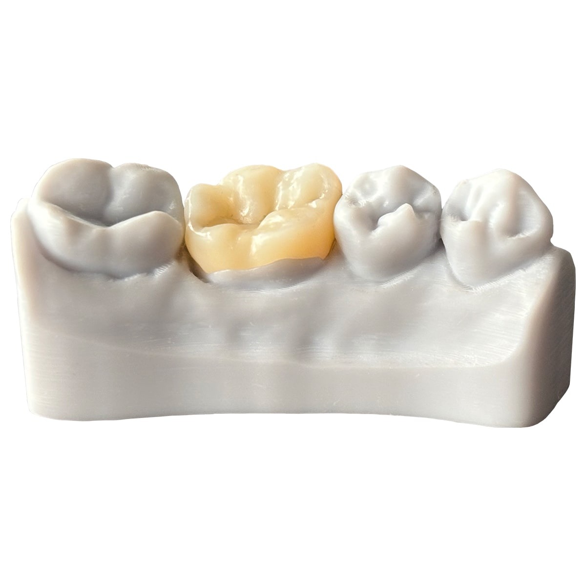 DFAB Chairside 3D Printer