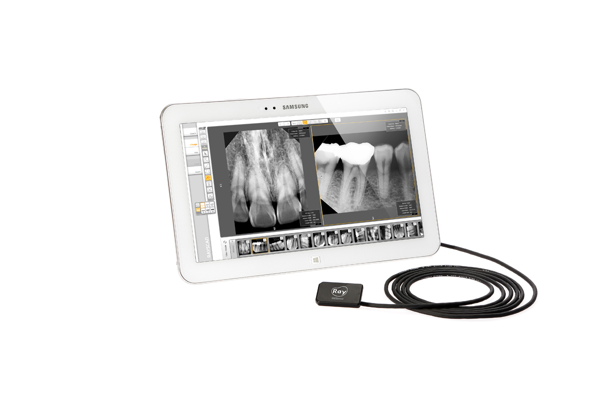 RIOSensor Intraoral Imaging Sensor