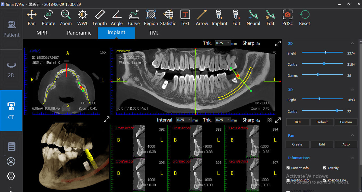 SmartVPro Dental Radiology Management Software