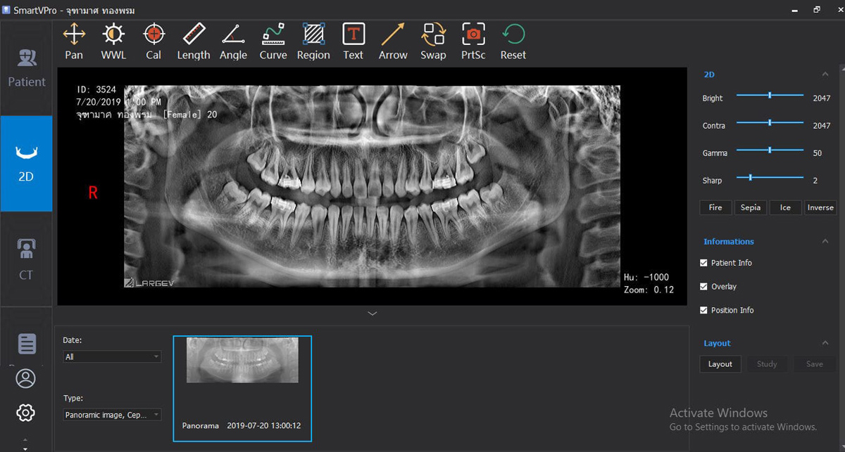 SmartVPro Dental Radiology Management Software